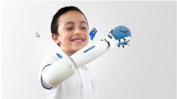 เด็กแขนพิการสามารถสร้างแขนเทียมขึ้นเองด้วยเลโก้